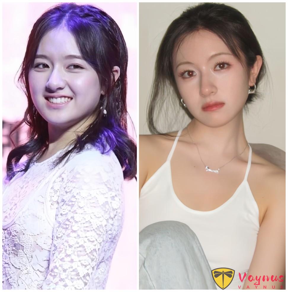 為什麼她們突然一個個全都瘦成這樣?乾瘦居然是新時尚?