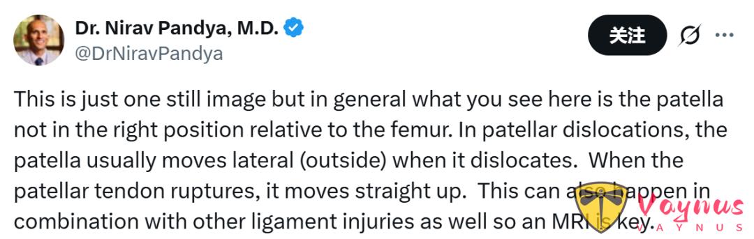 勇士遭遇重創!穆迪左膝重傷明日MRI!傷病專家給出最壞分析