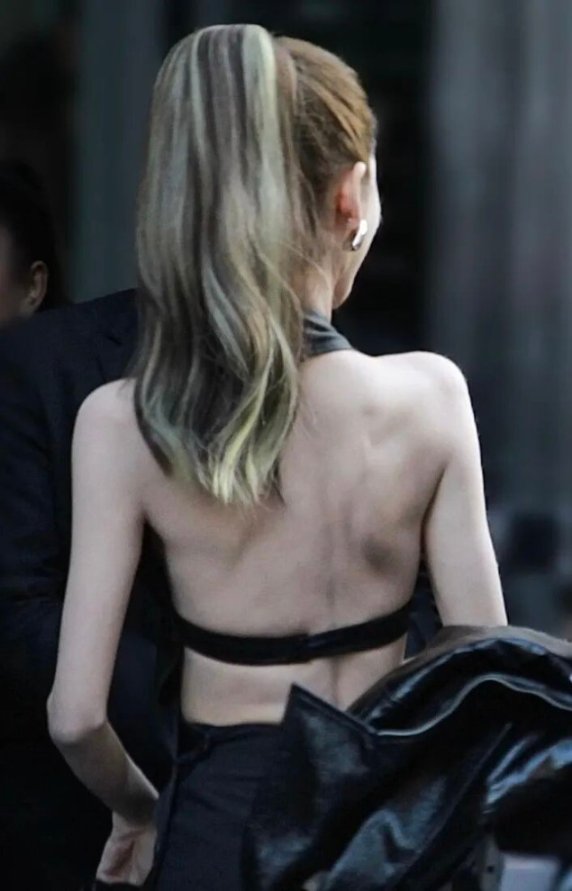 為什麼她們突然一個個全都瘦成這樣?乾瘦居然是新時尚?