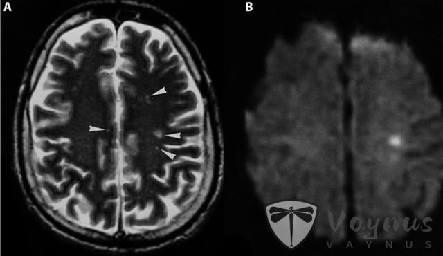 美国首次发现70%致死率的“亨尼帕病毒”后,印度又暴发了尼帕病毒疫情!多国出手应对,有游客紧急取消行程
