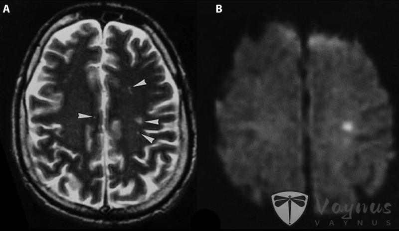 印度暴发疫情，死亡率曾一度高达 100%！国内曾发现高度相关病毒，有娃家庭该怎么防？
