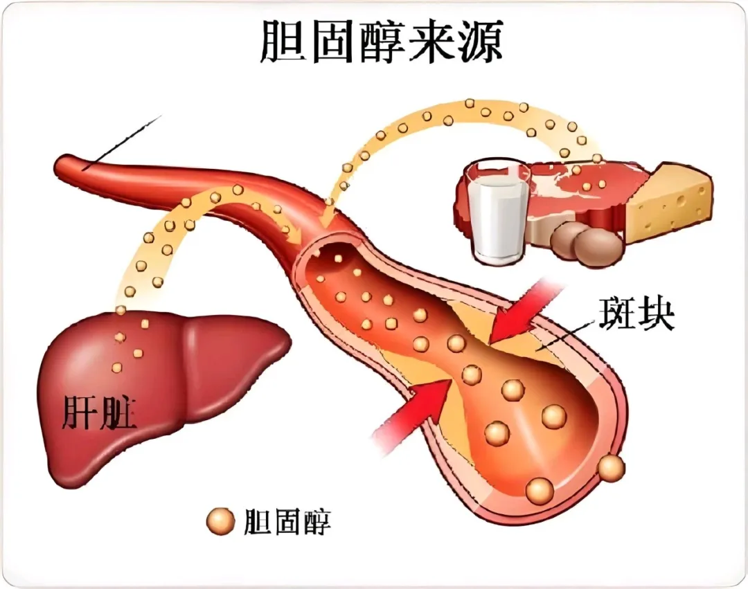 健身为什么要吃鸡蛋？蛋白质吸收率、胆固醇与每天吃几个